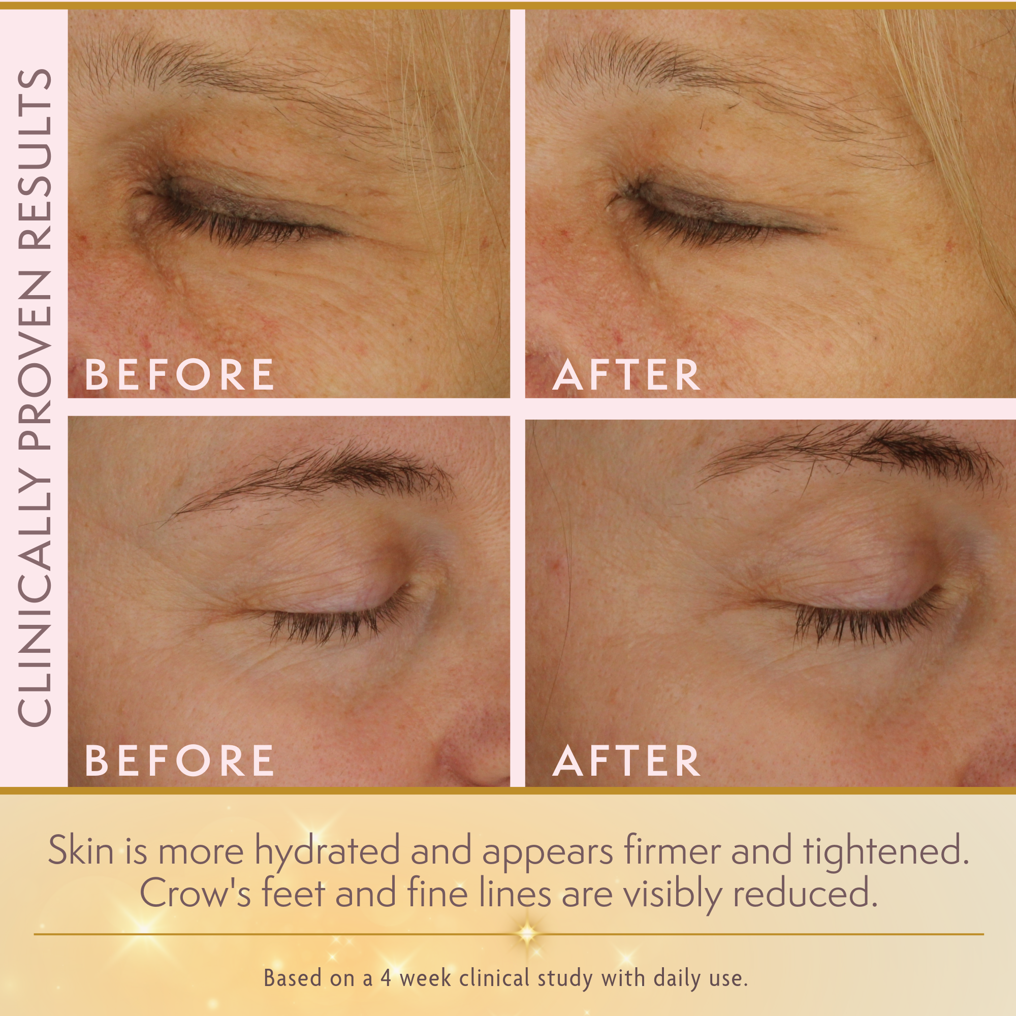 Goldie LuxTM 24K Gold Eye Cream