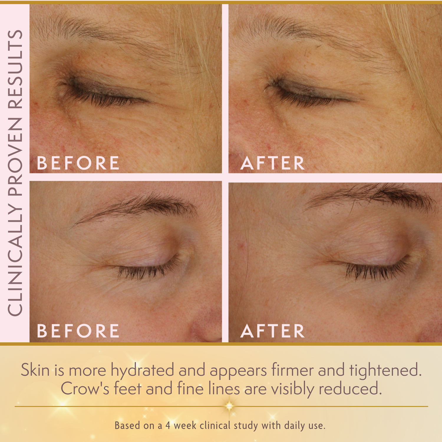 Goldie LuxTM 24K Gold Eye Cream