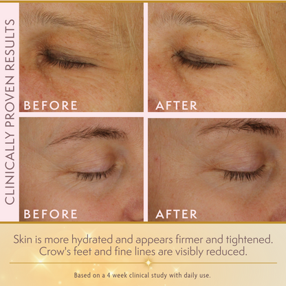 Goldie LuxTM 24K Gold Eye Cream